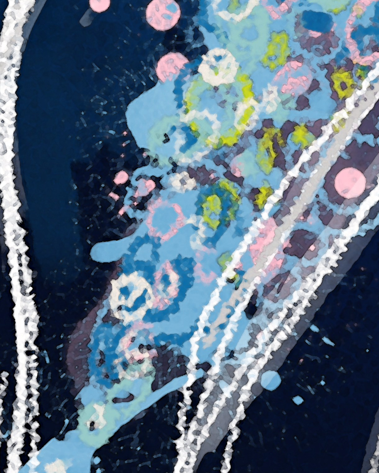 Blue Jellyfish Fine Coastal Art Canvas Print